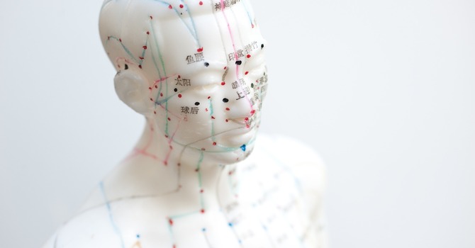 Traditional Chinese Acupuncture